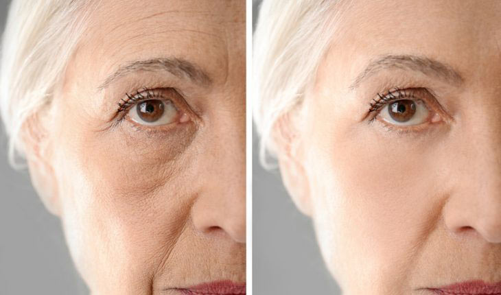 collagen benefits